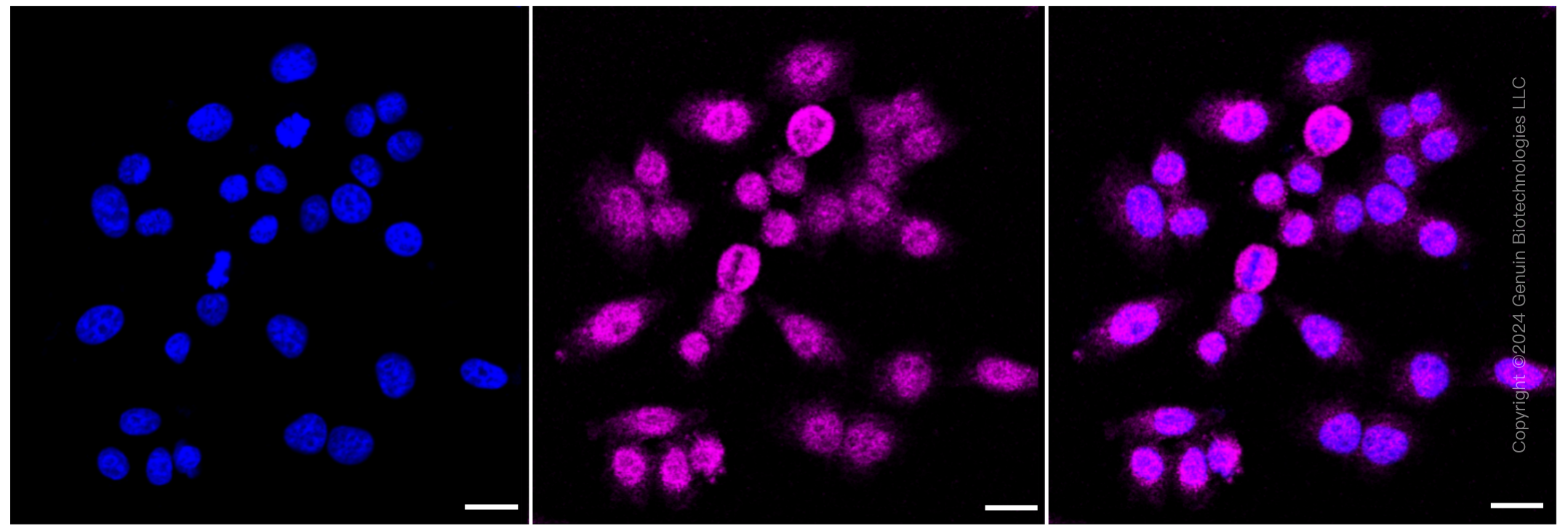 KD-Validated Anti-Eukaryotic translation elongation factor 2 Rabbit Monoclonal Antibody ABG1573