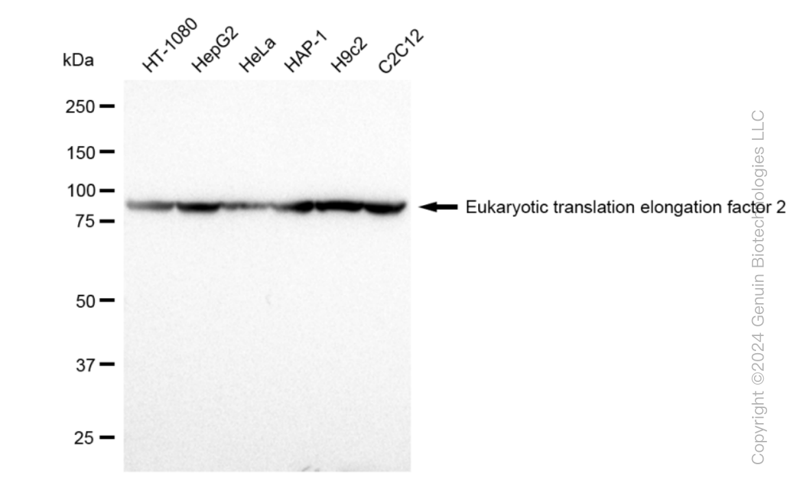 KD-Validated Anti-Eukaryotic translation elongation factor 2 Rabbit Monoclonal Antibody ABG1573
