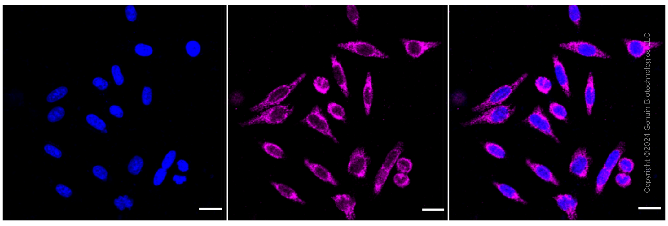 KD-Validated Anti-HDHD5 Rabbit Monoclonal Antibody ABG1574