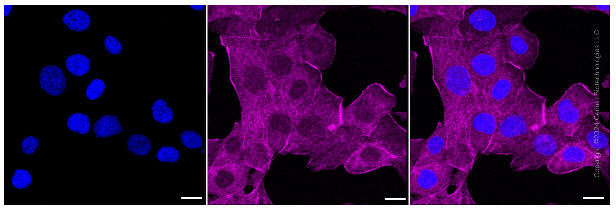 KD-Validated Anti-MLD Rabbit Monoclonal Antibody ABG1575