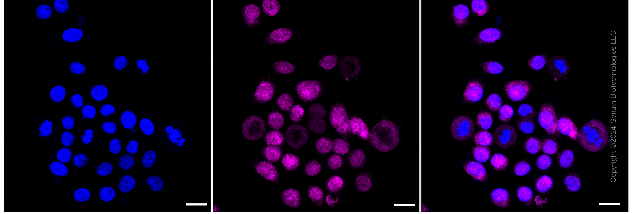 KD-Validated Anti-IL13 receptor alpha 1 Rabbit Monoclonal Antibody ABG1576