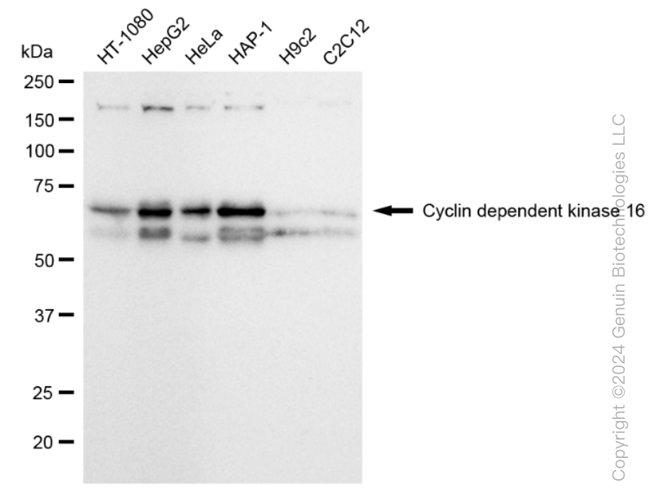 KD-Validated Anti-Cyclin dependent kinase 16 Rabbit Monoclonal Antibody ABG1577