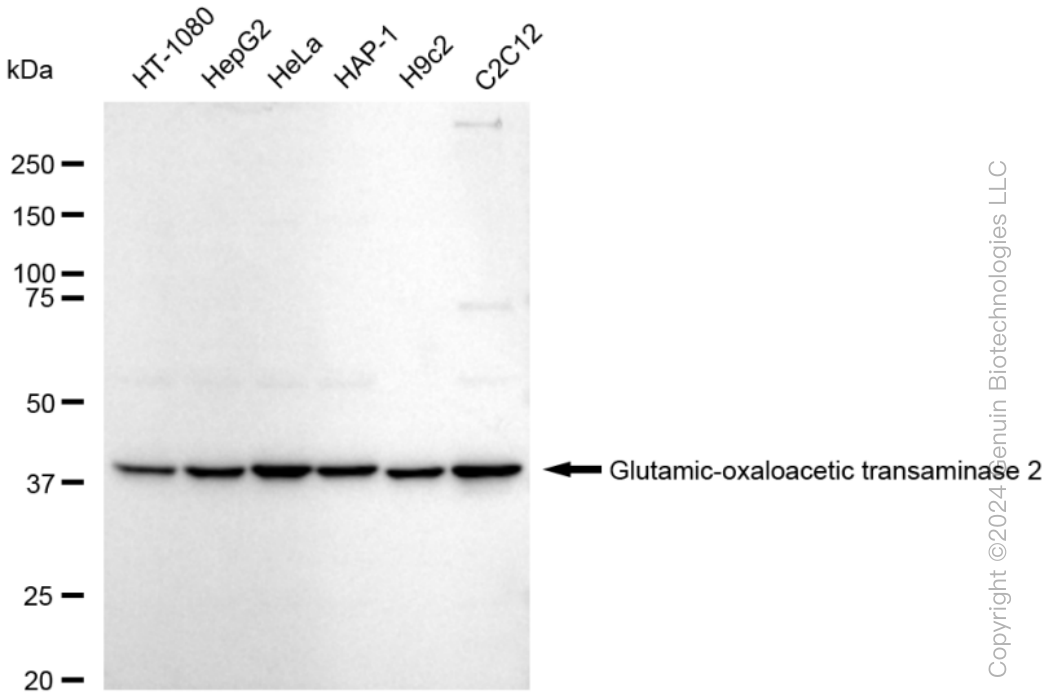 KD-Validated Anti-Glutamic-oxaloacetic transaminase 2 Rabbit Monoclonal Antibody ABG1579