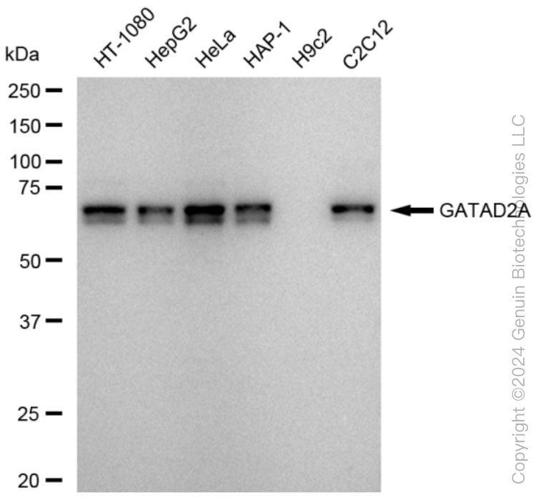 KD-Validated Anti-GATAD2A Rabbit Monoclonal Antibody ABG1580
