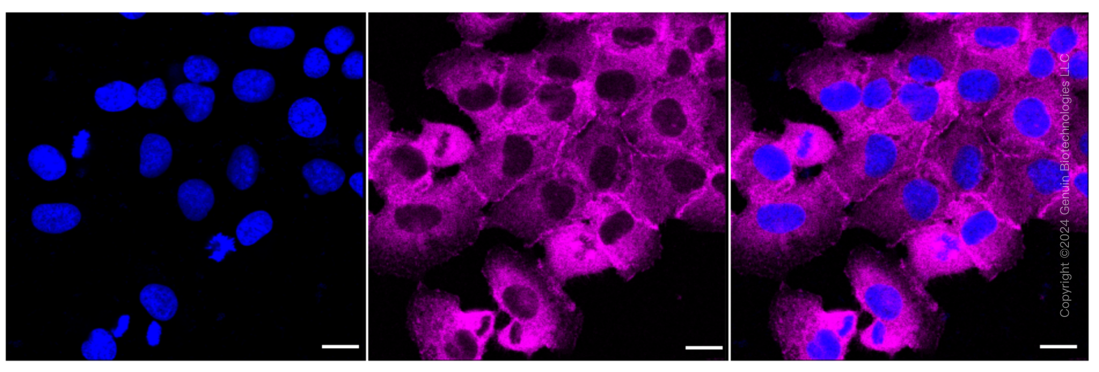 KD-Validated Anti-LPP Rabbit Monoclonal Antibody ABG1581