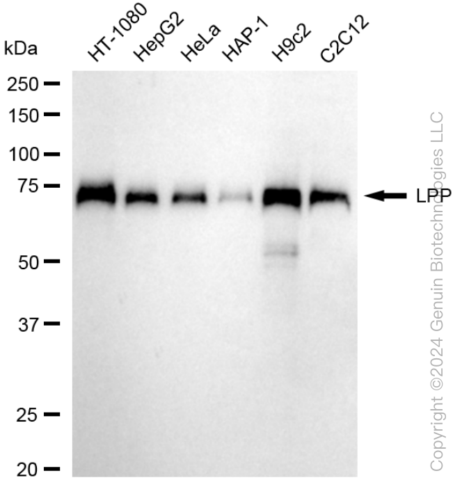 KD-Validated Anti-LPP Rabbit Monoclonal Antibody ABG1581