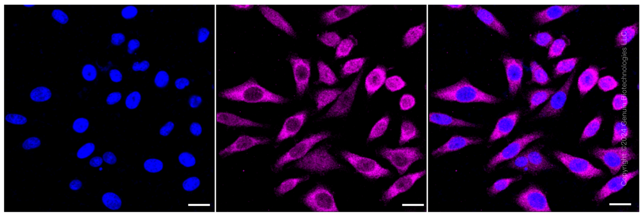 KD-Validated Anti-Non-SMC Condensin I Complex Subunit D2 Rabbit Monoclonal Antibody ABG1585