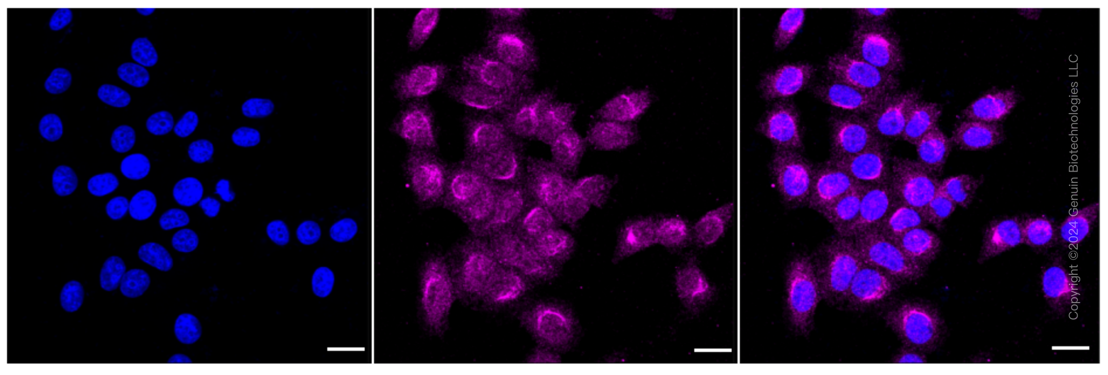 KD-Validated Anti-Mechanistic Target Of Rapamycin Kinase Rabbit Monoclonal Antibody ABG1589