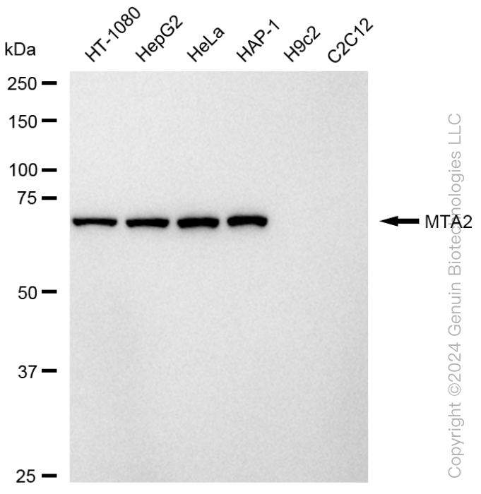 KD-Validated Anti-Metastasis Associated 1 Family Member 2 Rabbit Monoclonal Antibody ABG1604