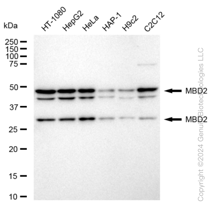 KD-Validated Anti-Methyl-CpG Binding Domain Protein 2 Rabbit Monoclonal Antibody ABG1606