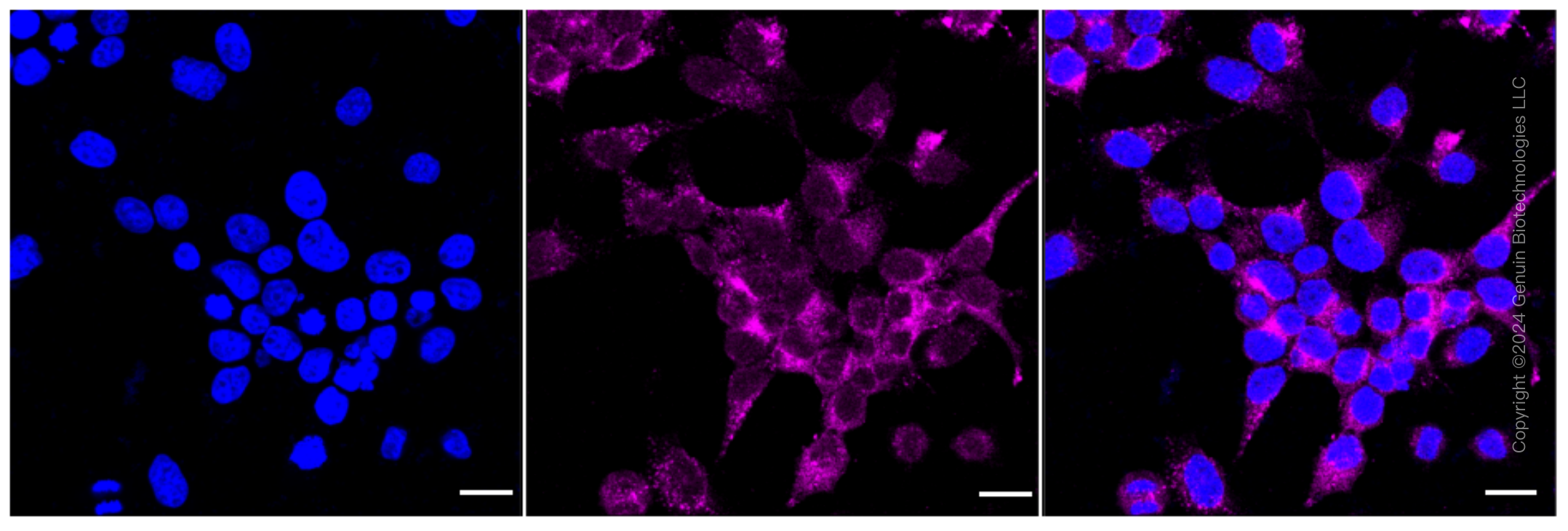 KD-Validated Anti-NSDHL Rabbit Monoclonal Antibody ABG1609