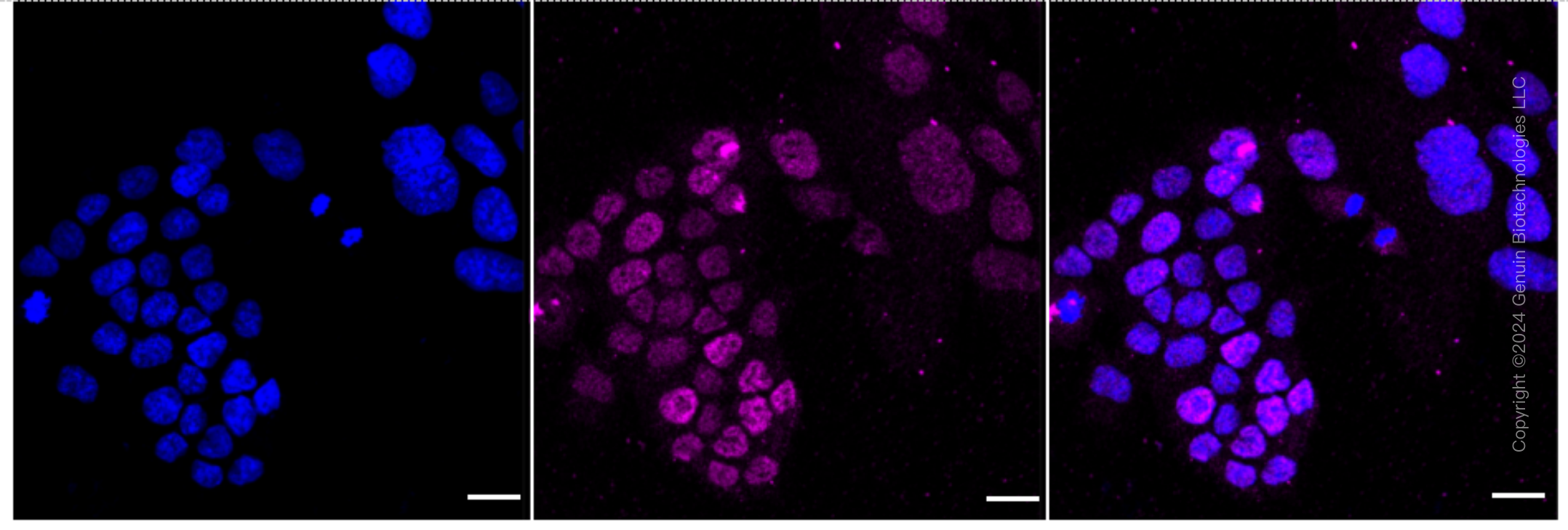 KD-Validated Anti-Matrin 3 Rabbit Monoclonal Antibody ABG1611
