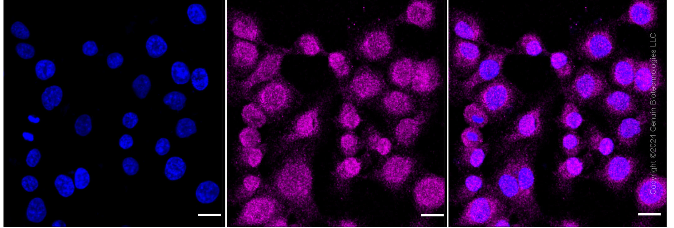 KD-Validated Anti-Leucine Rich Alpha-2-Glycoprotein 1 Rabbit Monoclonal Antibody ABG1612