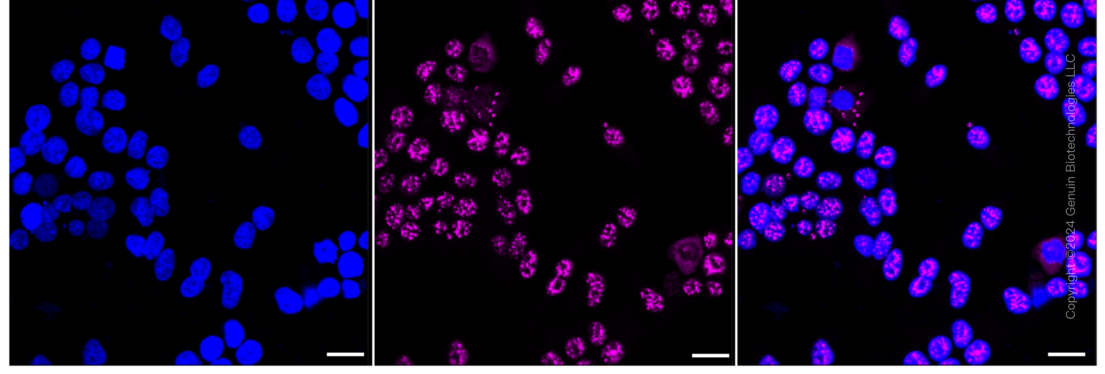 KD-Validated Anti-Mov10 RNA Helicase Rabbit Monoclonal Antibody ABG1614