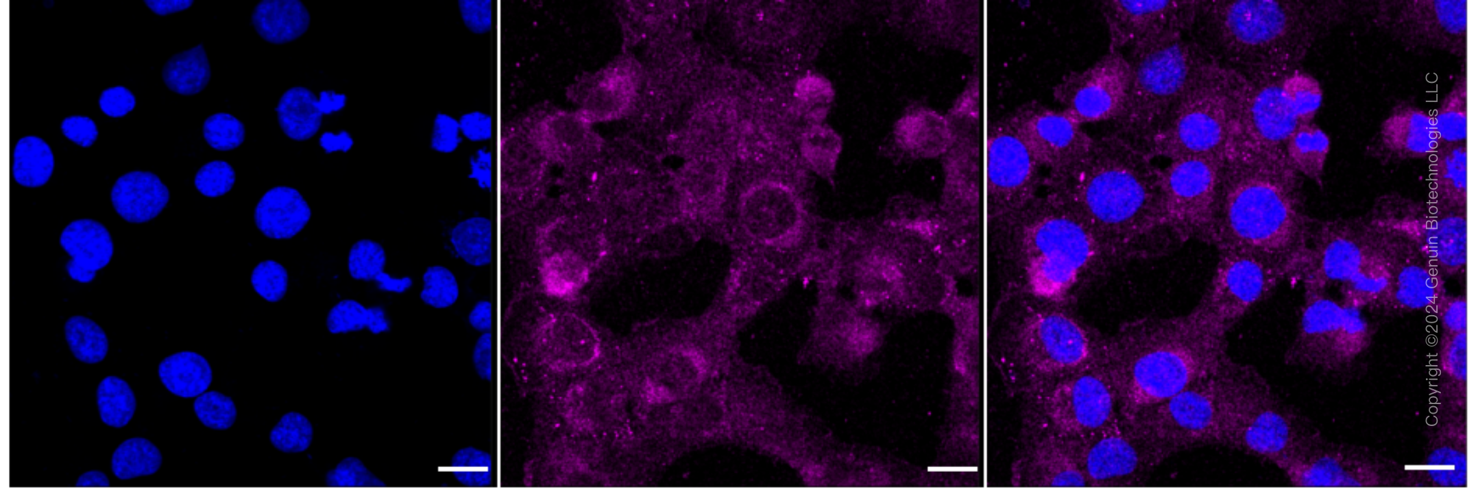 KD-Validated Anti-MARK2 Rabbit Monoclonal Antibody ABG1618