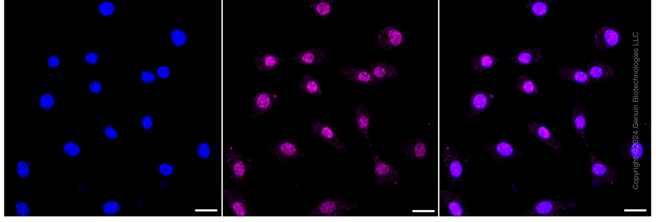 KD-Validated Anti-Olfactomedin 4 Rabbit Monoclonal Antibody ABG1619