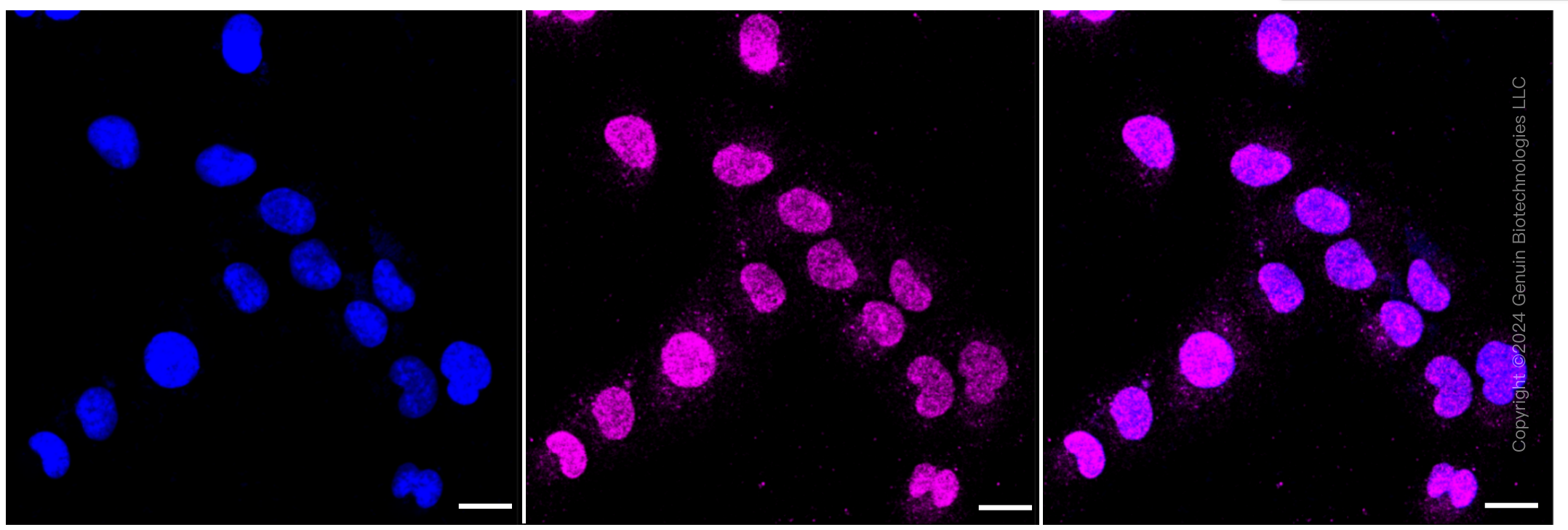 KD-Validated Anti-Galactosidase beta 1 Rabbit Monoclonal Antibody ABG1620