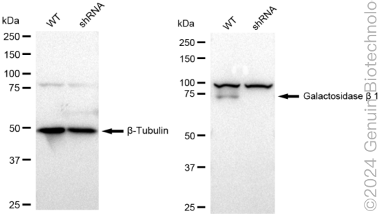 KD-Validated Anti-Galactosidase beta 1 Rabbit Monoclonal Antibody ABG1620