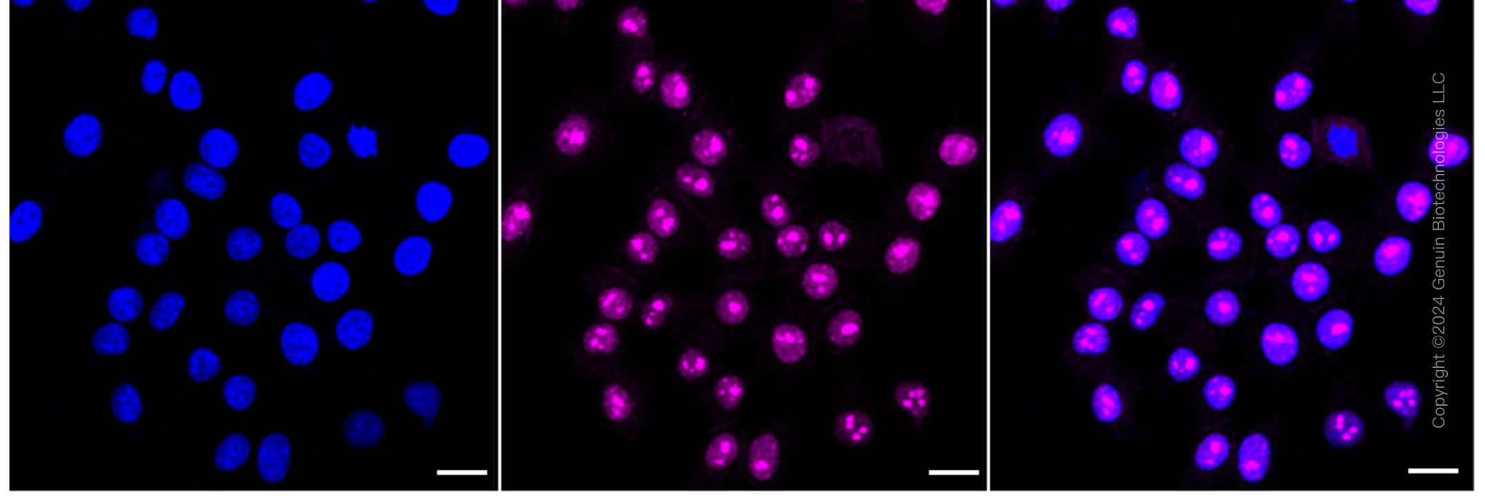 KD-Validated Anti-LYN Proto-Oncogene Rabbit Monoclonal Antibody ABG1621