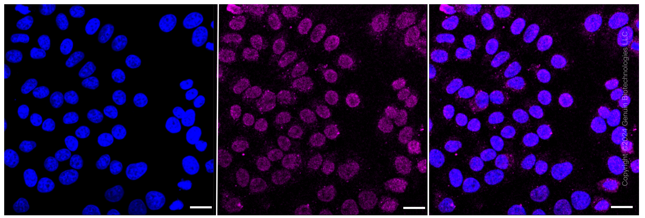 KD-Validated Anti-Pyruvate Dehydrogenase E2 Rabbit Monoclonal Antibody ABG1623