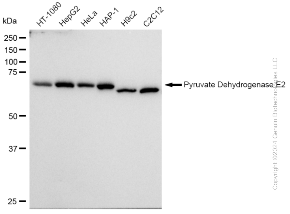 KD-Validated Anti-Pyruvate Dehydrogenase E2 Rabbit Monoclonal Antibody ABG1623