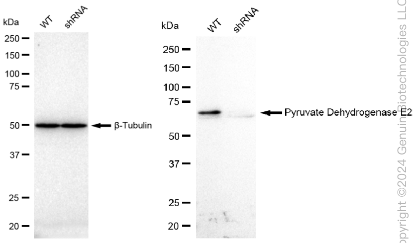 KD-Validated Anti-Pyruvate Dehydrogenase E2 Rabbit Monoclonal Antibody ABG1623