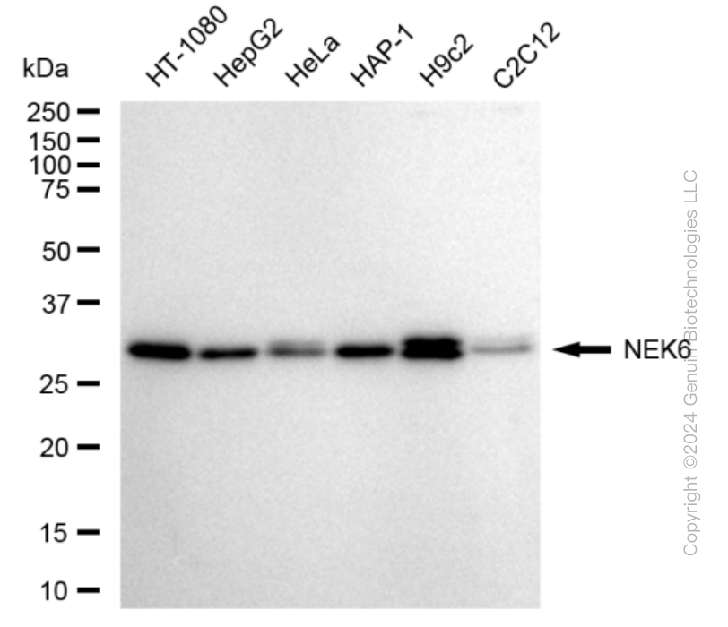 KD-Validated Anti-NIMA Related Kinase 6 Rabbit Monoclonal Antibody ABG1624