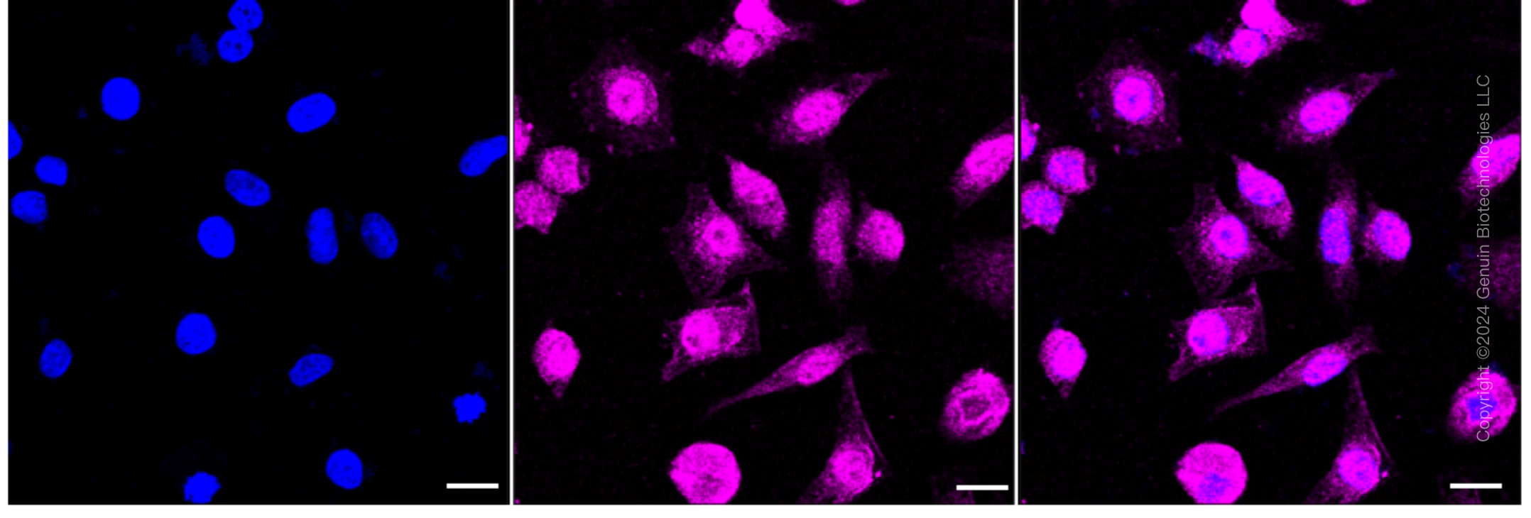KD-Validated Anti-RAVER2 Rabbit Monoclonal Antibody ABG1627