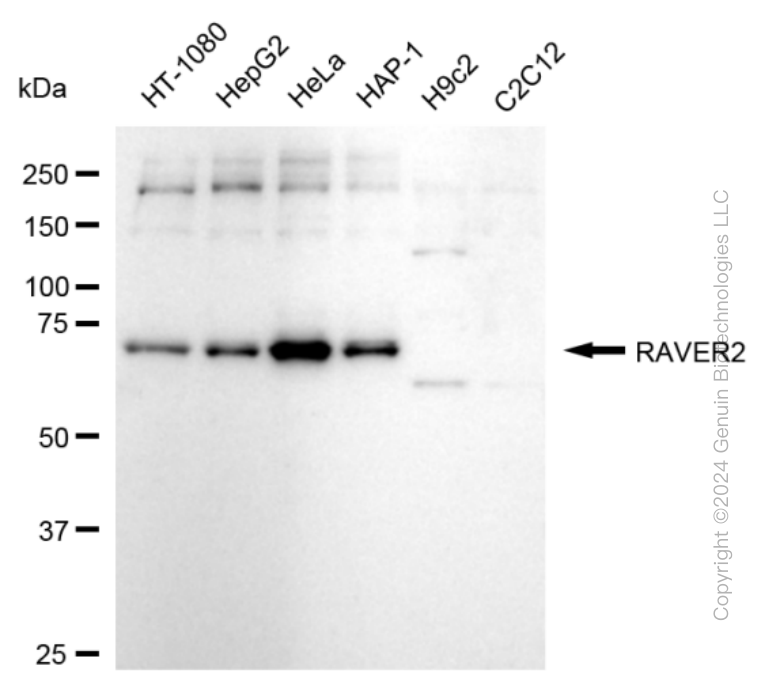 KD-Validated Anti-RAVER2 Rabbit Monoclonal Antibody ABG1627