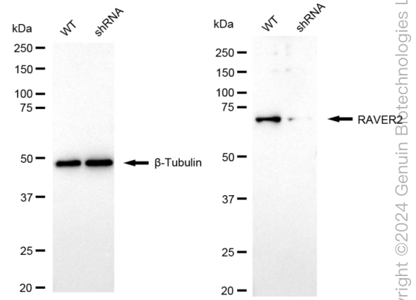 KD-Validated Anti-RAVER2 Rabbit Monoclonal Antibody ABG1627