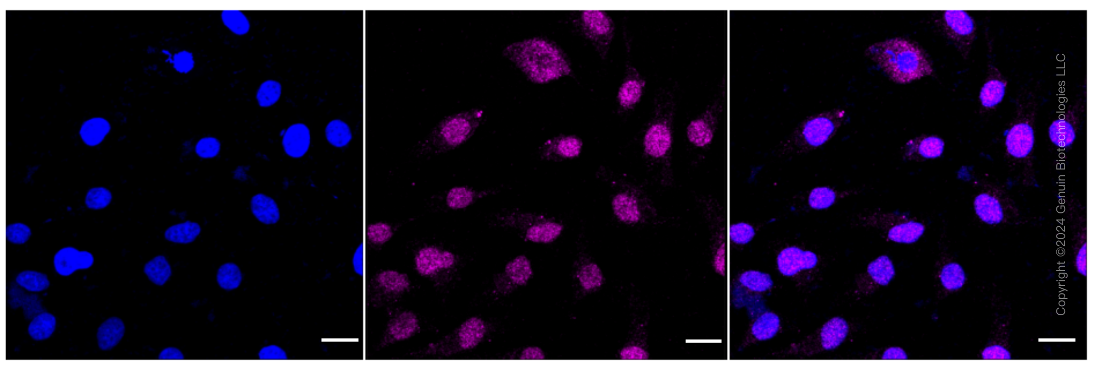 KD-Validated Anti-PSIP1 / LEDGF Rabbit Monoclonal Antibody ABG1629