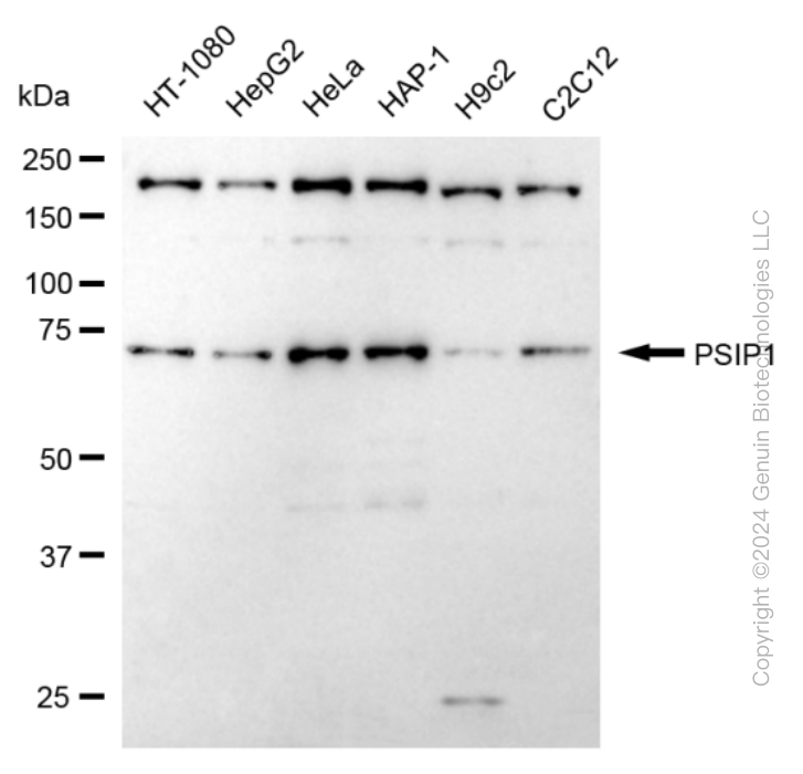 KD-Validated Anti-PSIP1 / LEDGF Rabbit Monoclonal Antibody ABG1629
