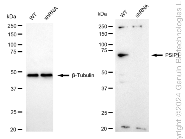 KD-Validated Anti-PSIP1 / LEDGF Rabbit Monoclonal Antibody ABG1629