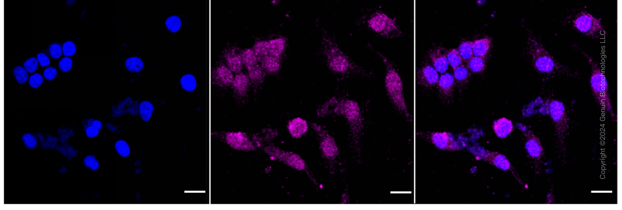 KD-Validated Anti-PBP Rabbit Monoclonal Antibody ABG1631