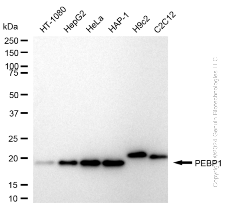 KD-Validated Anti-PBP Rabbit Monoclonal Antibody ABG1631