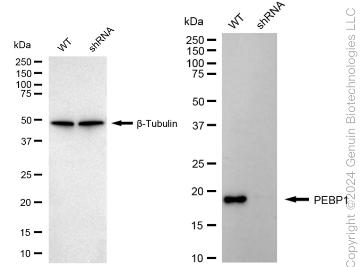 KD-Validated Anti-PBP Rabbit Monoclonal Antibody ABG1631
