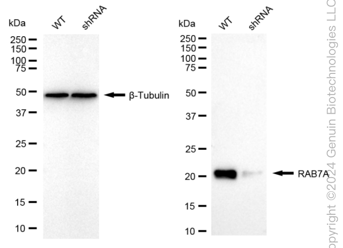KD-Validated Anti-RAB7 Rabbit Monoclonal Antibody ABG1633