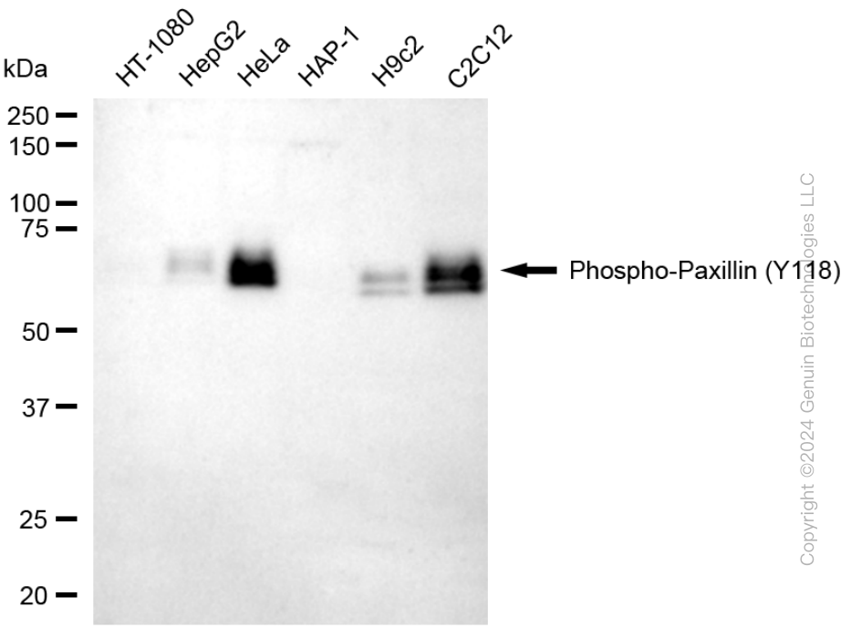 KD-Validated Anti-Phospho-Paxillin (Y118) Rabbit Monoclonal Antibody ABG1634