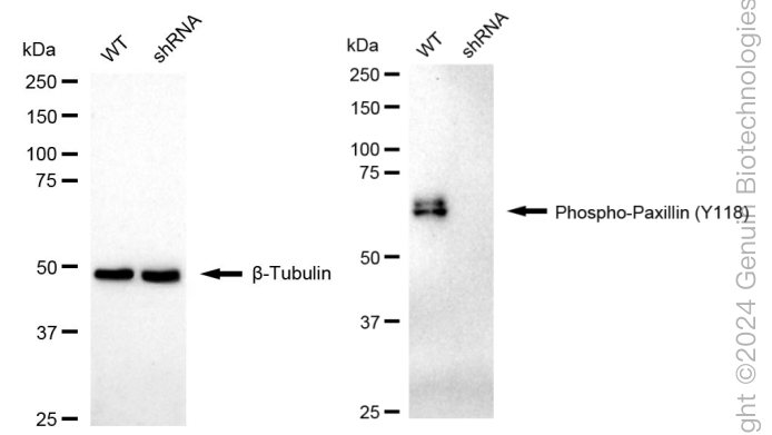 KD-Validated Anti-Phospho-Paxillin (Y118) Rabbit Monoclonal Antibody ABG1634