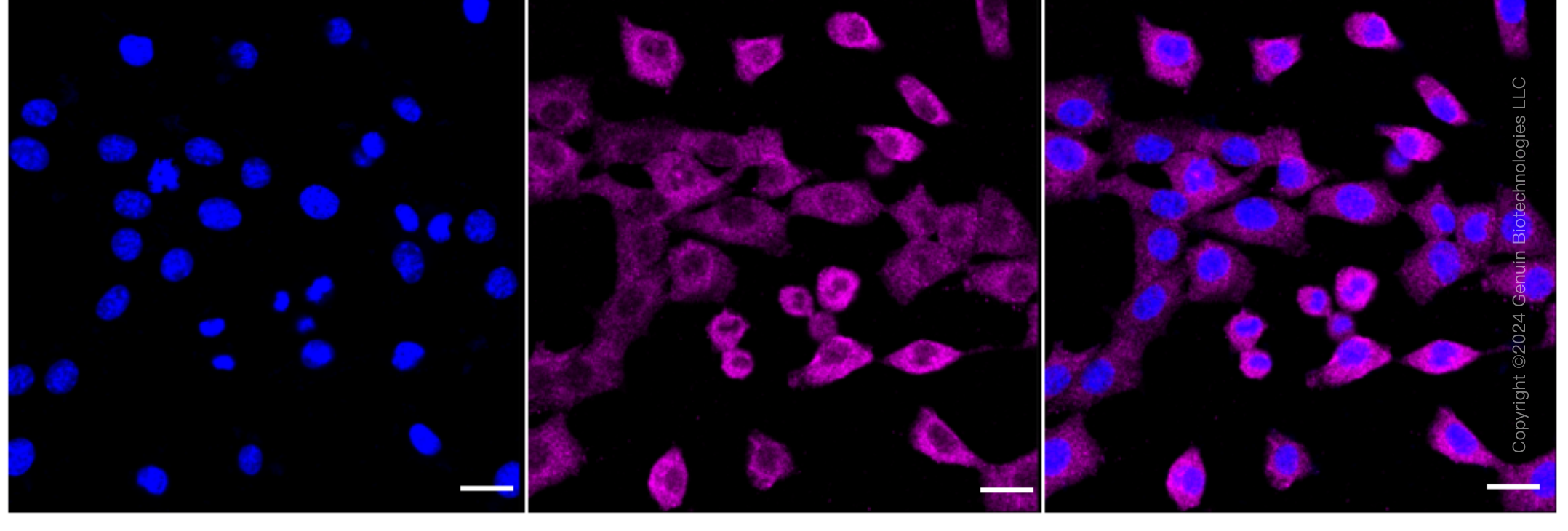 KD-Validated Anti-RelB Rabbit Monoclonal Antibody ABG1637
