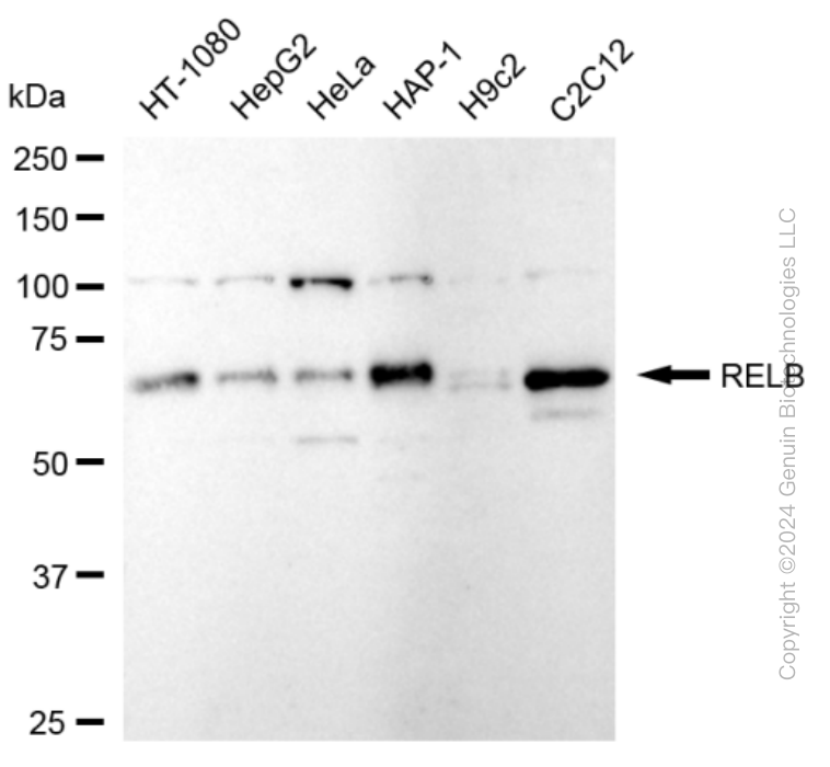 KD-Validated Anti-RelB Rabbit Monoclonal Antibody ABG1637