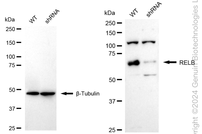 KD-Validated Anti-RelB Rabbit Monoclonal Antibody ABG1637