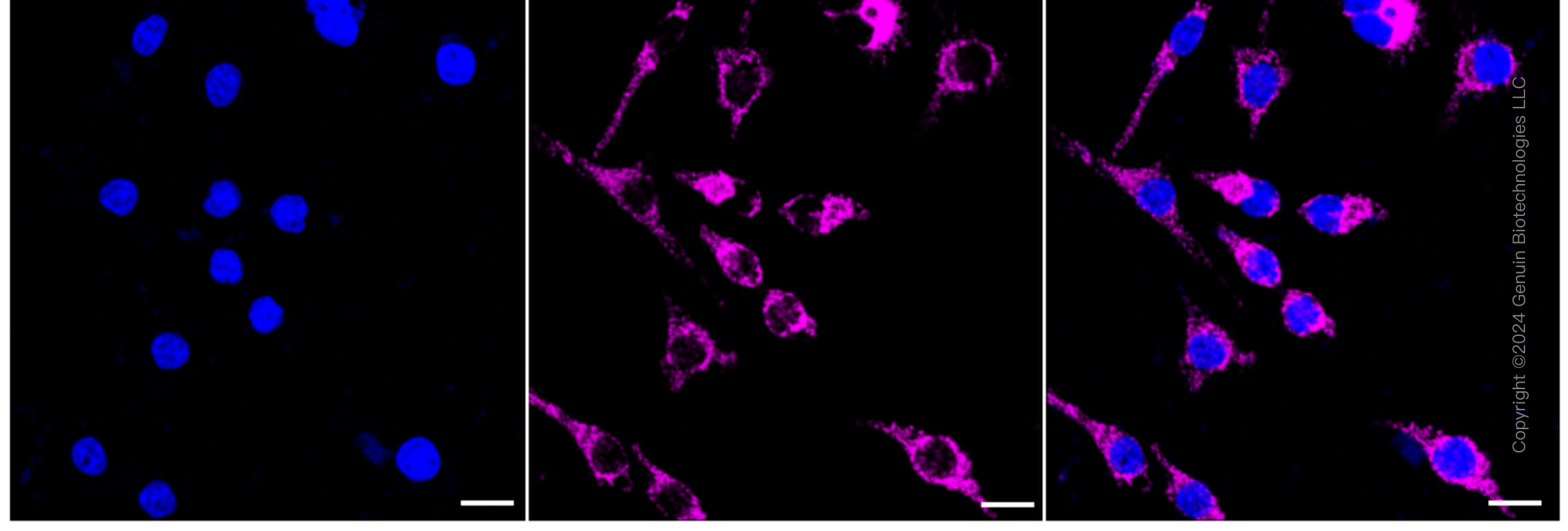 KD-Validated Anti-Peroxiredoxin 3 Rabbit Monoclonal Antibody ABG1638