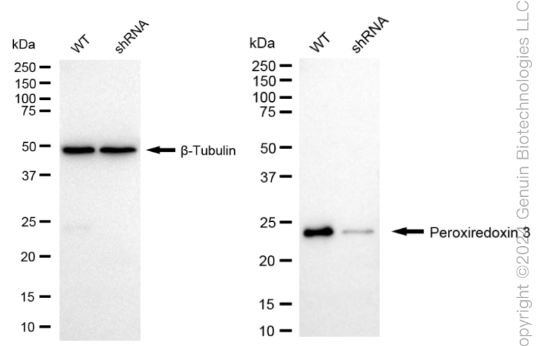 KD-Validated Anti-Peroxiredoxin 3 Rabbit Monoclonal Antibody ABG1638
