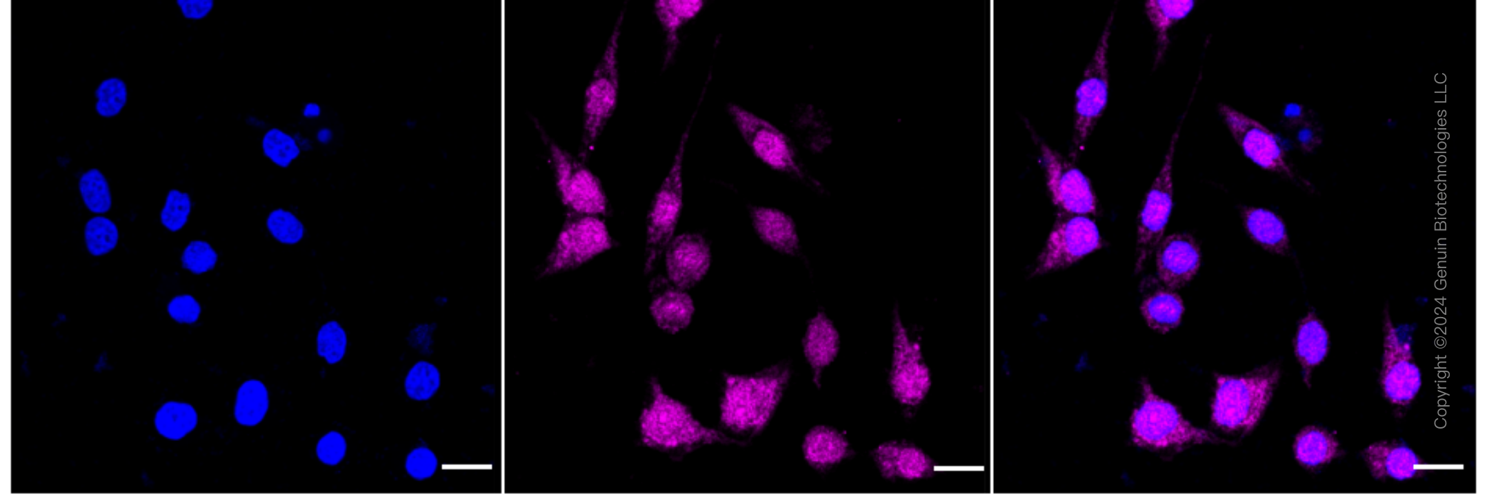 KD-Validated Anti-Prolyl Endopeptidase Like Rabbit Monoclonal Antibody ABG1641
