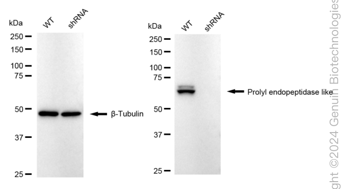 KD-Validated Anti-Prolyl Endopeptidase Like Rabbit Monoclonal Antibody ABG1642