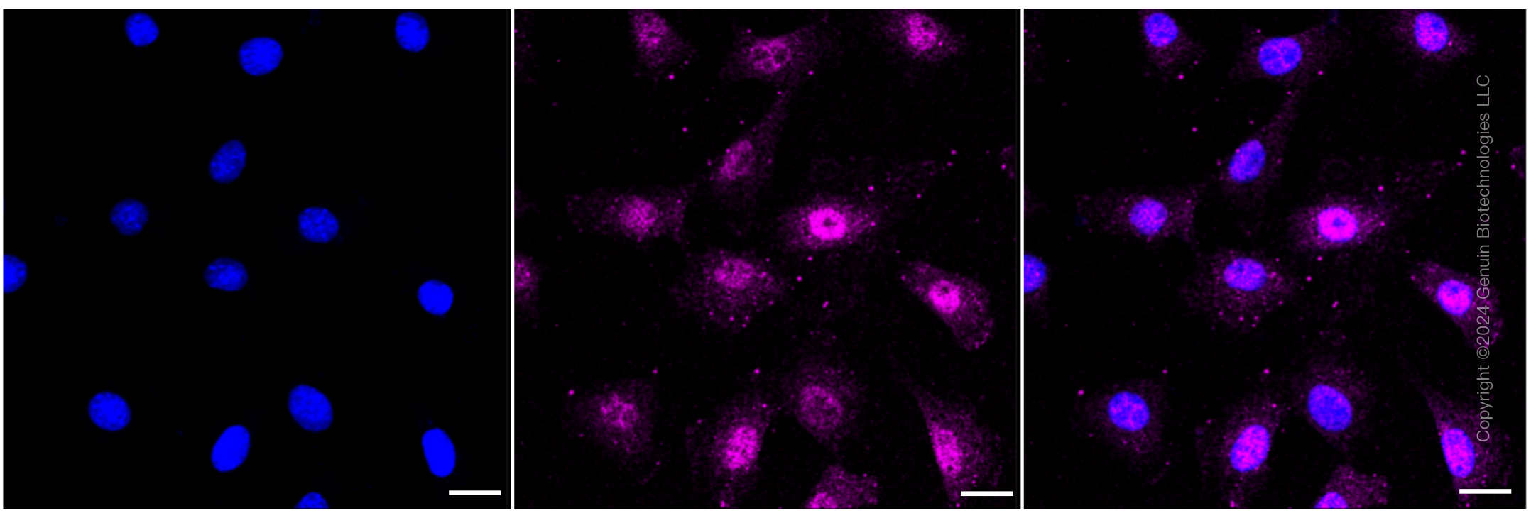 KD-Validated Anti-Phospho-AKT1 (S124) Rabbit Monoclonal Antibody ABG1643