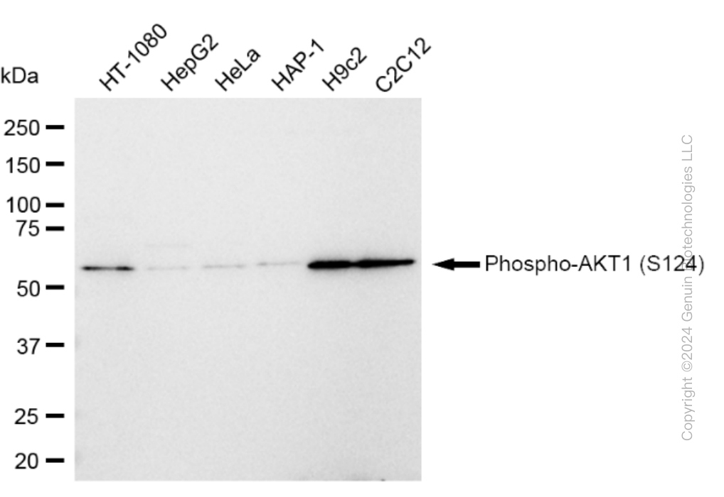KD-Validated Anti-Phospho-AKT1 (S124) Rabbit Monoclonal Antibody ABG1643