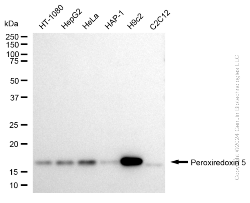 KD-Validated Anti-Peroxiredoxin 5 Rabbit Monoclonal Antibody ABG1645