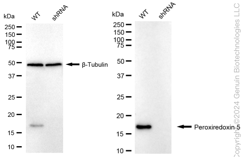 KD-Validated Anti-Peroxiredoxin 5 Rabbit Monoclonal Antibody ABG1645